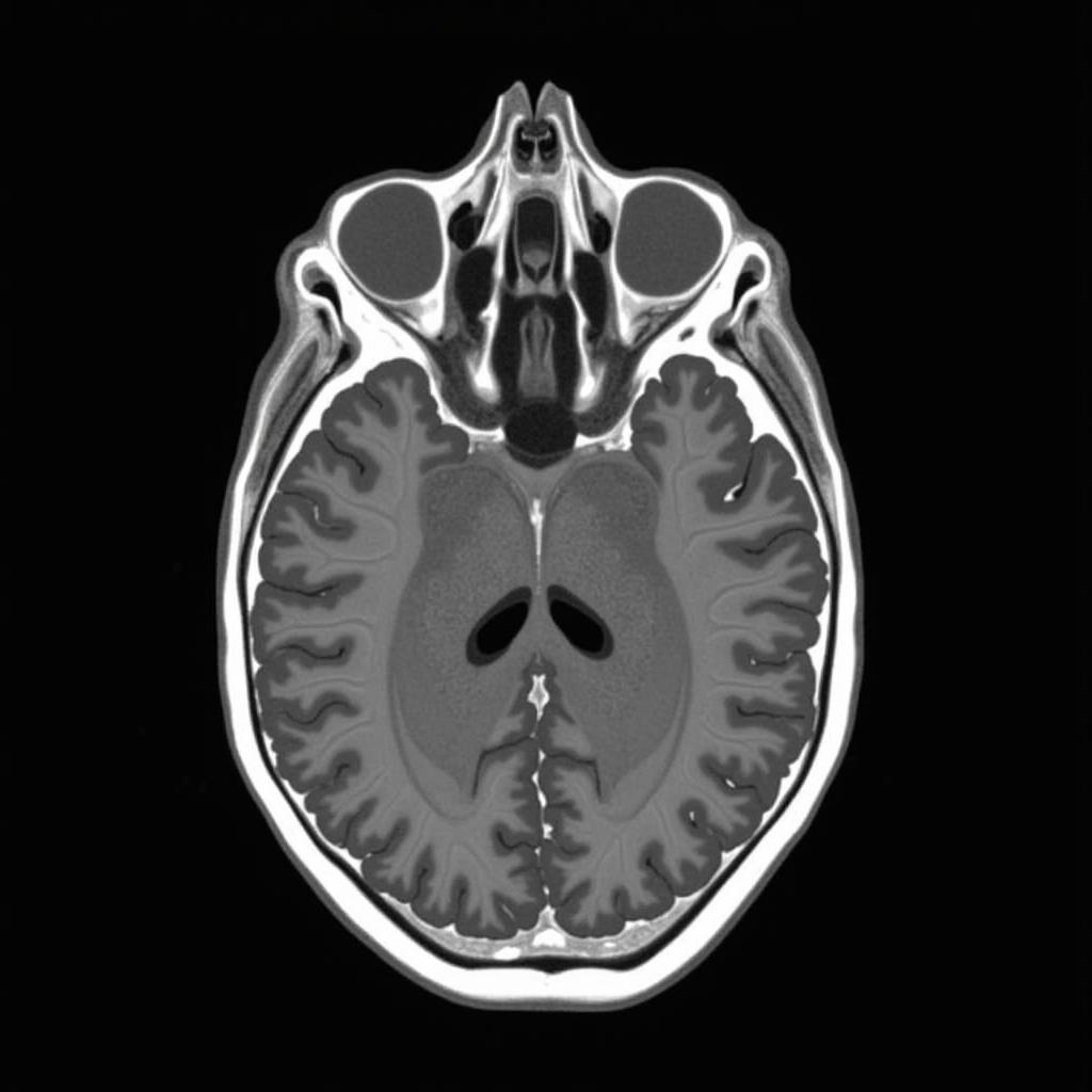 Fan Beam CT Brain Scan